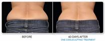 coolscrupting- female- before and after